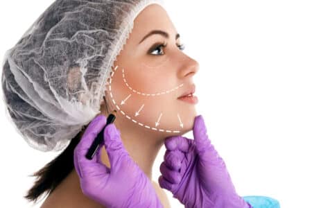 chirurgie esthétique